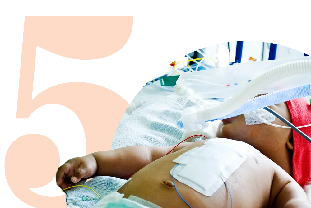 Increased Birth Anomalies Will Require More Complex Care